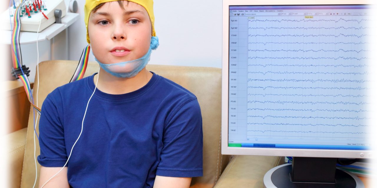 ¿Por qué los registros de EEG deberían incluir siempre fases de sueño?
