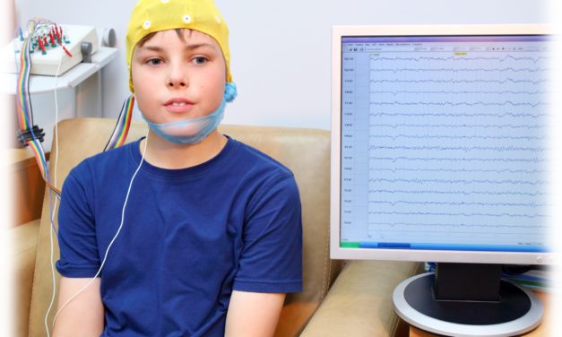 ¿Por qué los registros de EEG deberían incluir siempre fases de sueño?