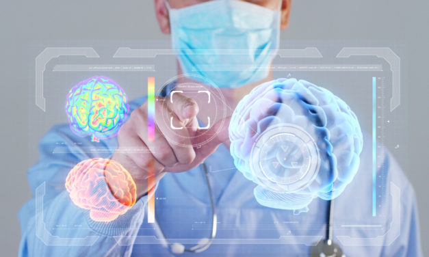 ¿Porqué falla la cirugía de epilepsia? Un nuevo estudio ofrece posibles soluciones para mejorar sus resultados