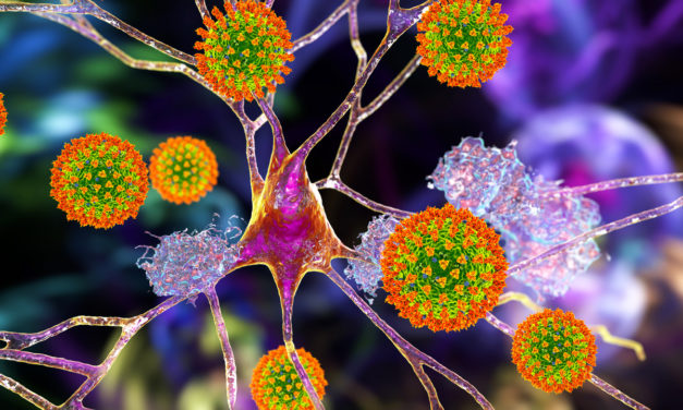 ¿Podría la pandemia COVID-19 asociarse a un futuro aumento de los casos de epilepsia en el mundo?