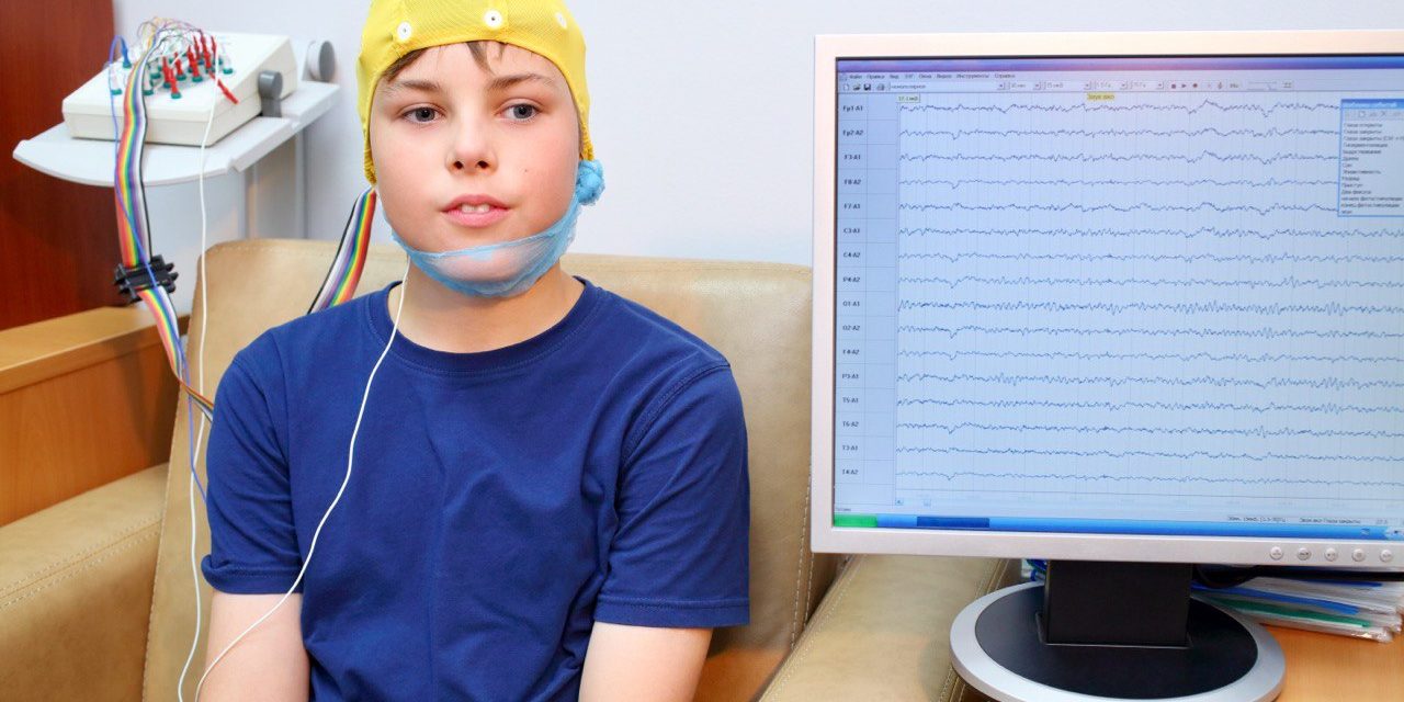 ¿Puedo tener un EEG con anomalías epileptiformes y no tener epilepsia?