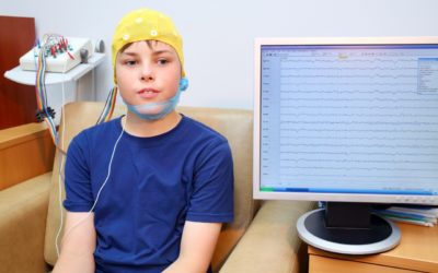 ¿Sigue siendo importante el EEG para el diagnostico de la Epilepsia?