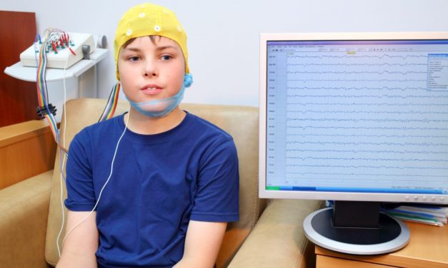 ¿Puedo tener un EEG con anomalías epileptiformes y no tener epilepsia?